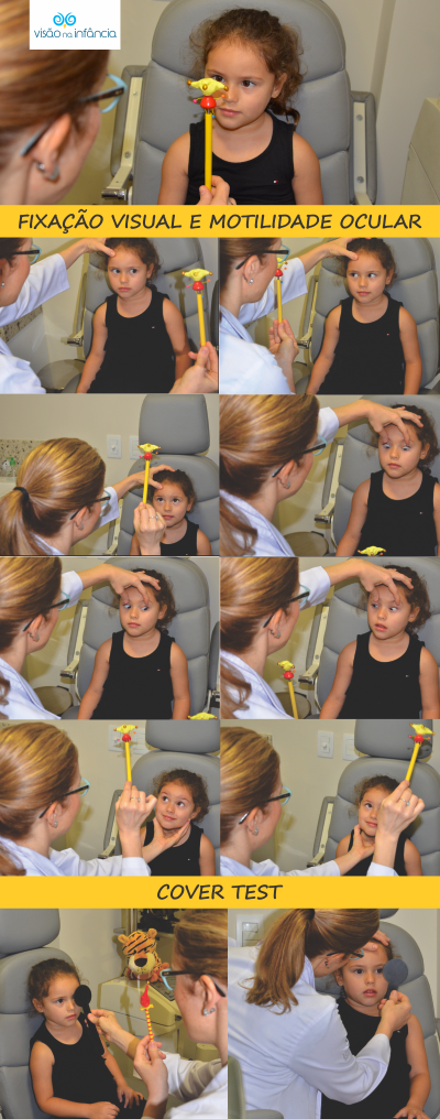 exames oftalmológicos para avaliação e tratamento de estrabismo